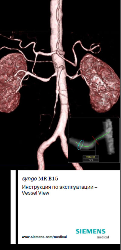 Инструкция по эксплуатации, Operation (Instruction) manual на Томограф ПО syngo MR B15 Vessel View